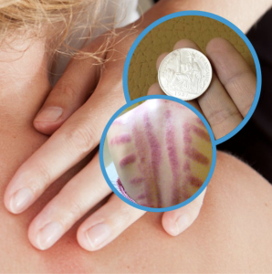 Sử dụng bạc 925 có gây kích ứng không? 